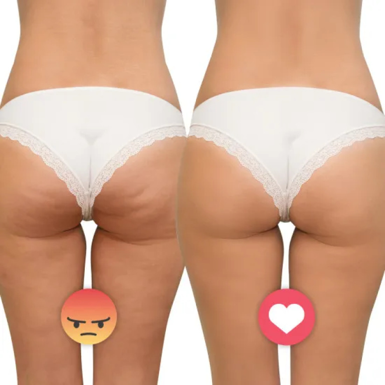 Συσκευή Μασάζ Ultrasonic Massager inSPORTline Valeri - Image 6